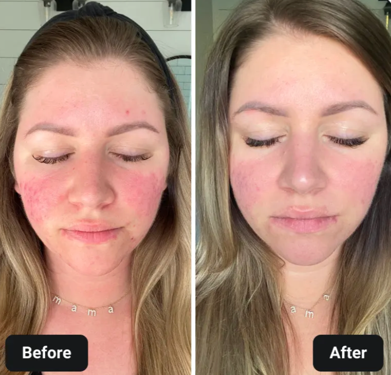 ZAVA Papaya Leaf Extract – Immunity & Digestion Aid*