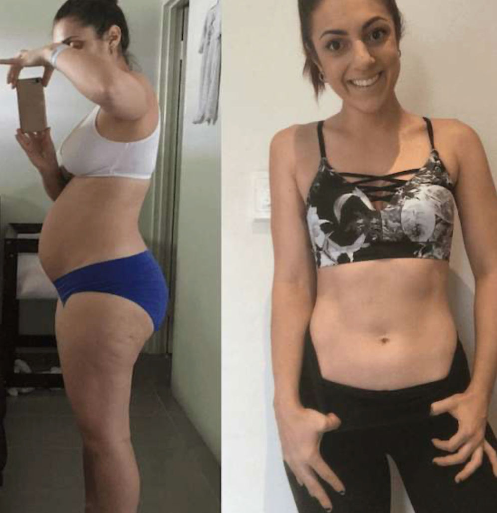 ZAVA Papaya Leaf Extract – Immunity & Digestion Aid*